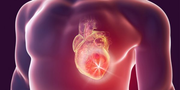 Cardiac Blood Test